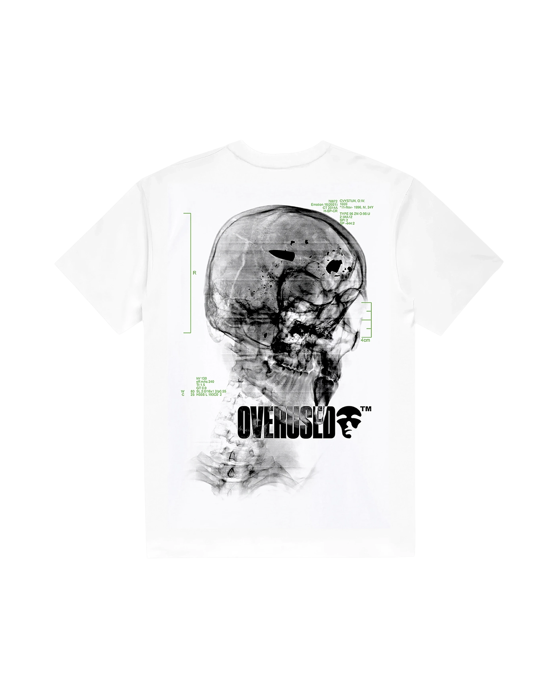 1101 WHITE T-SHIRT (FIT NORMAL)